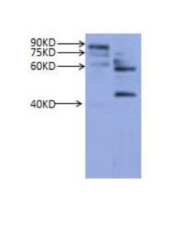 western blot using PR10, pathogenesis-related protein 10